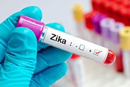 Johns Hopkins opens first-known multidisciplinary Zika virus center