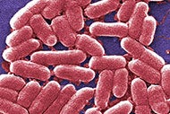 E. coli gene that can spread antibiotic resistance discovered in U.S. patient