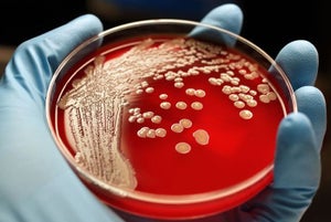 WHO ranks 12 bacteria families that pose greatest health risks