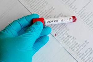 CDC works to prevent Legionella and a multidrug-resistant fungus in health facilities