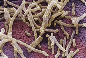 Study identifies the top surfaces where C. difficile persists