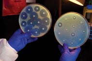 CDC issues appeal to stop growth of &#039;nightmare&#039; bacteria