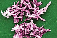 Study says patients infected with Clostridium difficile are twice as likely to be readmitted