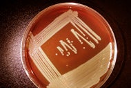 Wisconsin battles new bacteria threat known as Elizabethkingia